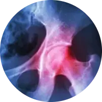 image of pain