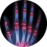 image of pain