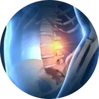 image of pain